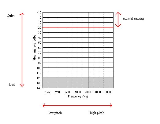 Audiogram using HL. Source: Wikipedia, http://en.wikipedia.org/wiki/File:Audio23.jpg