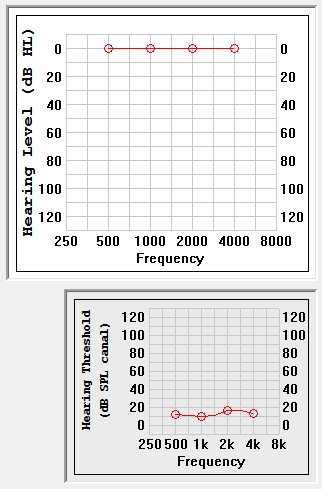 Audiogram using dB HL vs. dB SPL